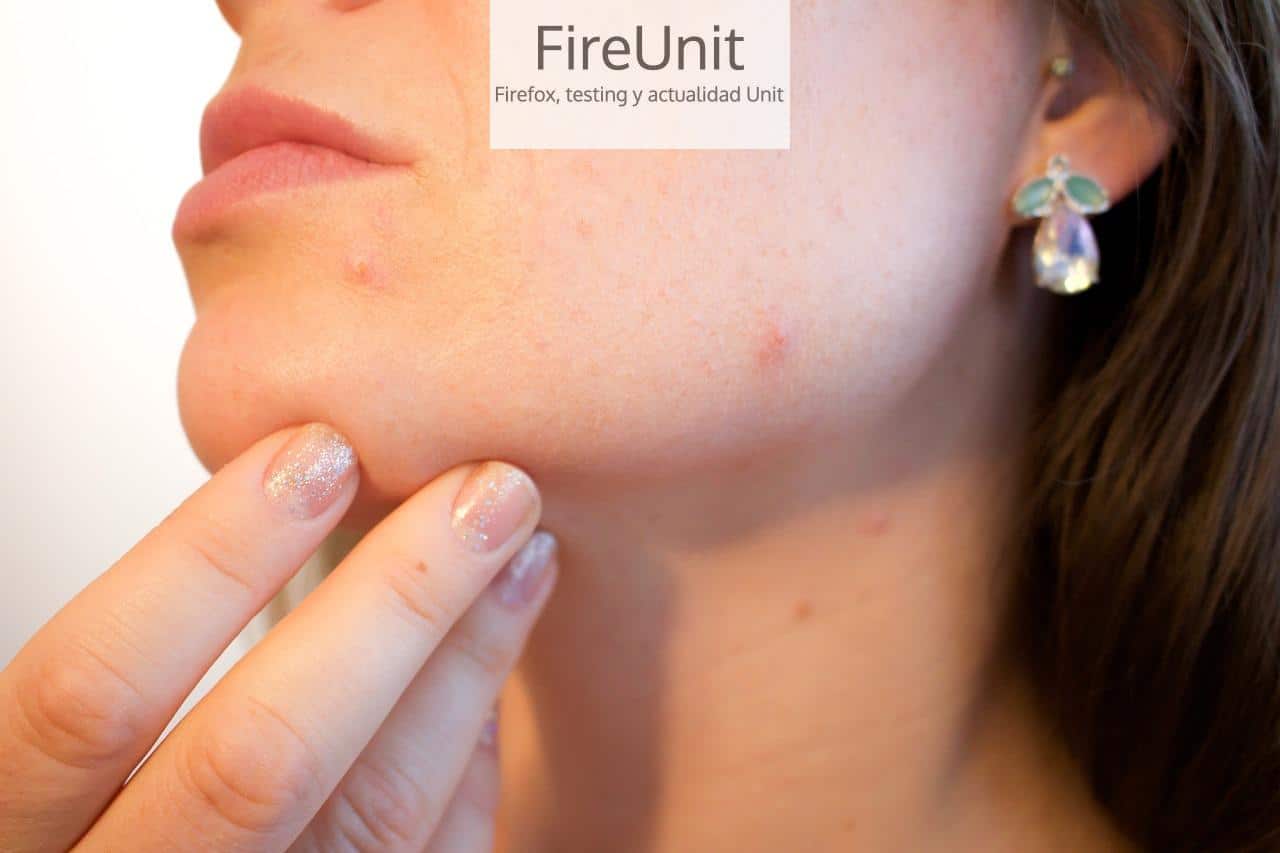 cricatriz facial